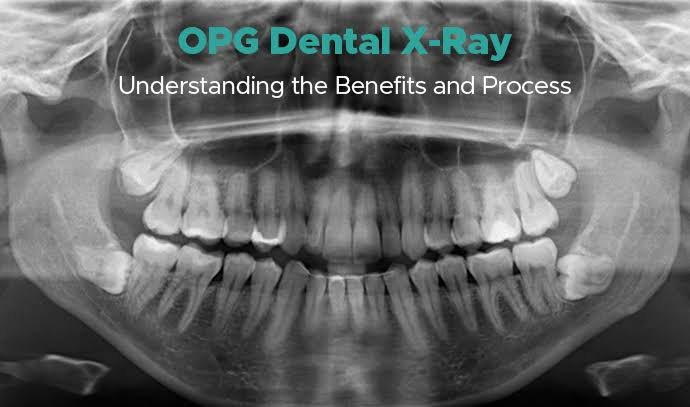 Digital dental X-ray and imaging